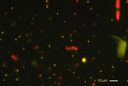 Picoplancton observé par épifluorescence